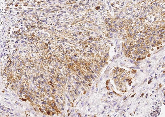 Recombinant Cathepsin D/CTSD Monoclonal Antibody-searchlist-1
