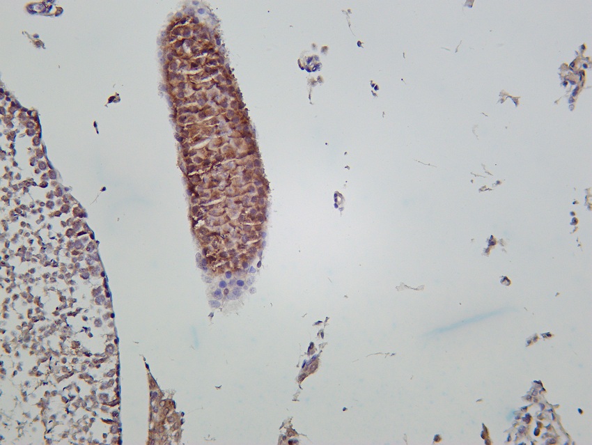 Recombinant PI3-Kinase p85 α Monoclonal Antibody - small - 4