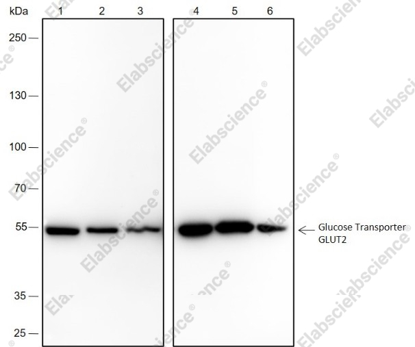 Recombinant GLUT2 Monoclonal Antibody - 1