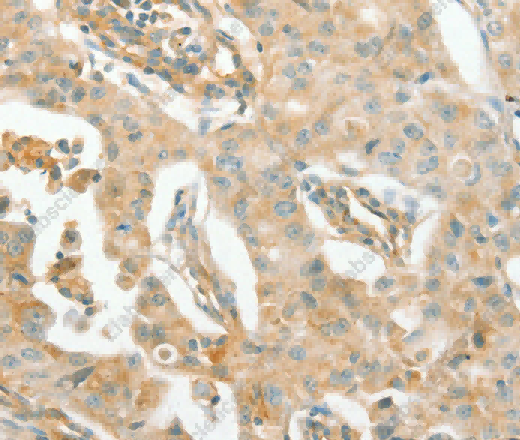 ACE1 Polyclonal Antibody - 3