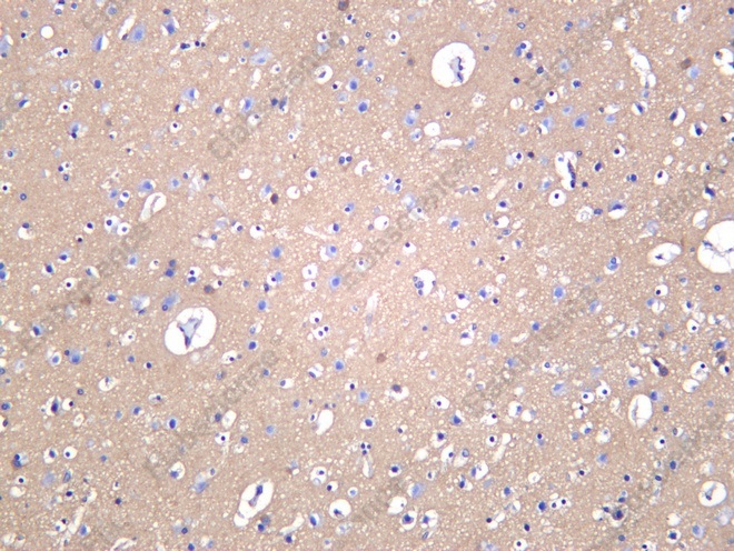 Recombinant CACNA2D Monoclonal Antibody - 1