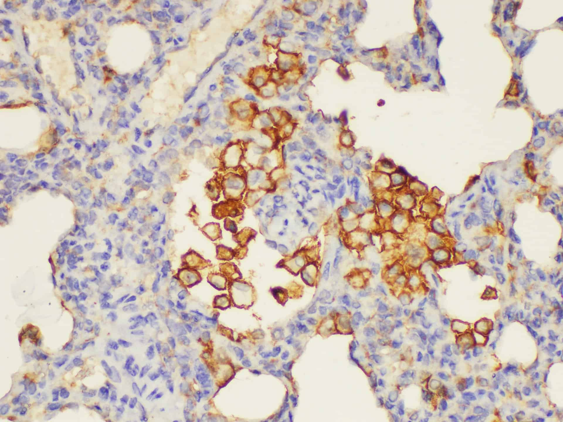 Immunohistochemistry of paraffin-embedded Rat lung using ANXA5 Ployclonal Antibody at dilution of 1:100.