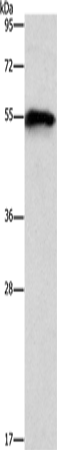 Western Blot analysis of Mouse heart tissue using CDK19 Polyclonal Antibody at dilution of 1:1000