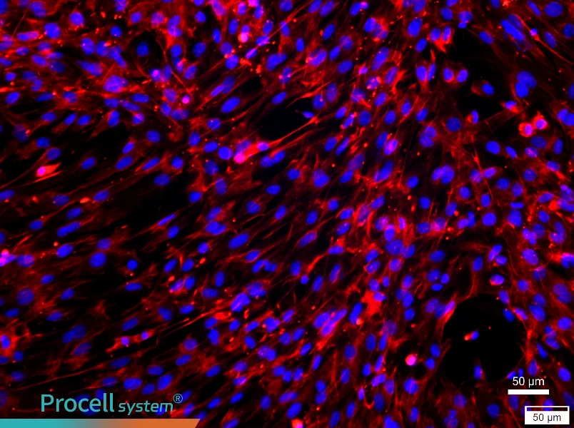 Mouse Lung Fibroblast Complete Medium - 1