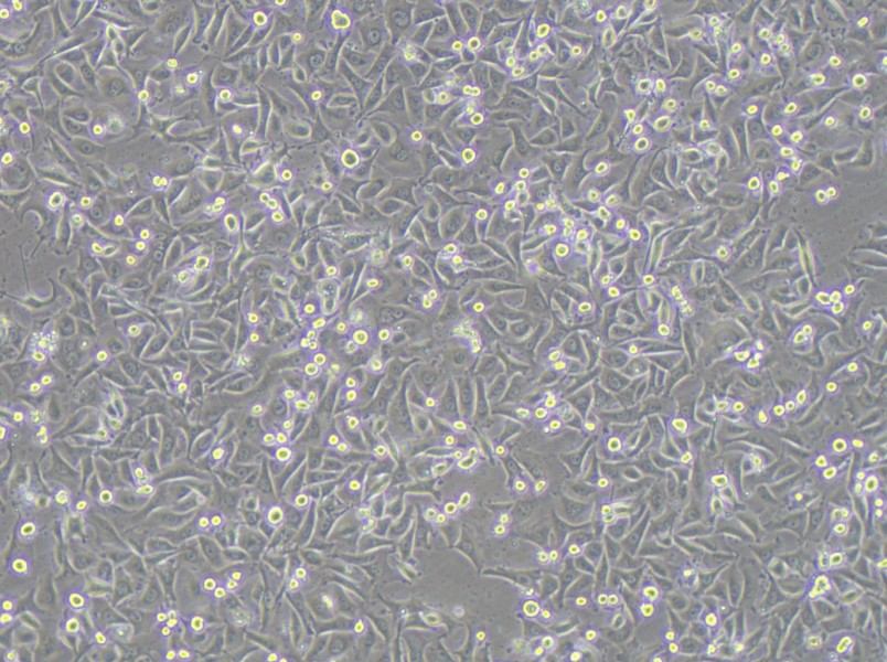 MKN1 Cell Complete MediumMKN1 Cell Complete Medium - 2