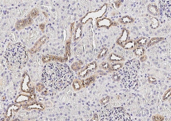 Recombinant Fractalkine/CX3CL1 Monoclonal Antibody - small - 2