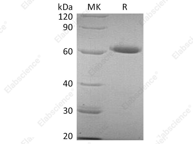 Recombinant Human CD73/NT5E Protein (His Tag) - 1