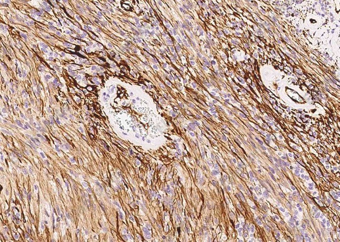 Nestin/NES Monoclonal Antibody - 2
