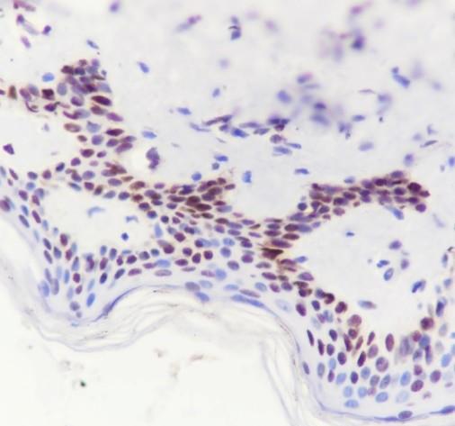 Recombinant DDB2 Monoclonal Antibody - 2