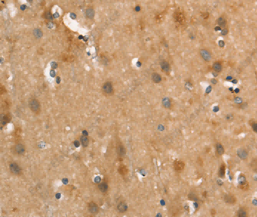 CALCRL Polyclonal Antibody - 3