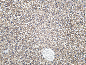 Recombinant RPN1 Monoclonal Antibody - 2