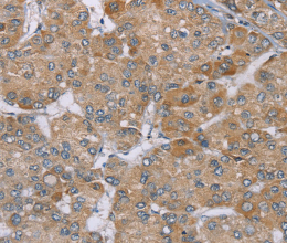 ACTN2 Polyclonal Antibody - 2