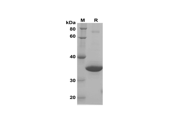 Recombinant Mouse ALCAM/CD166 Protein(His Tag)-产品推荐-1
