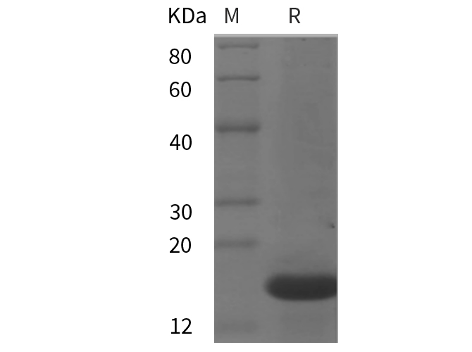 Recombinant Mouse IL-33 Protein(Trx Tag)-产品推荐-1