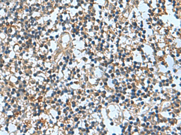 Immunohistochemistry of paraffin-embedded Human tonsil tissue  using TRO Polyclonal Antibody at dilution of 1:65(?200)