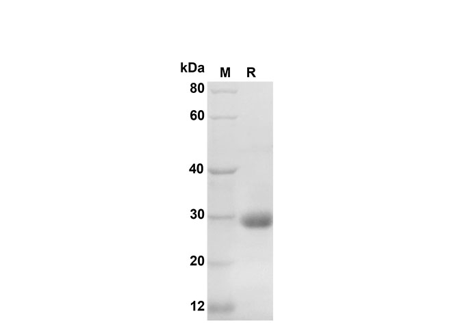 Recombinant Rat IFN-γ Protein(GST Tag)-产品推荐-1