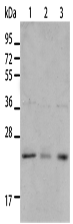 Western Blot analysis of A431 and A172 cell, Human liver cancer tissue using BNIP1 Polyclonal Antibody at dilution of 1:550