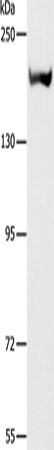 Western Blot analysis of Mouse kidney tissue using ACE1 Polyclonal Antibody at dilution of 1:1000