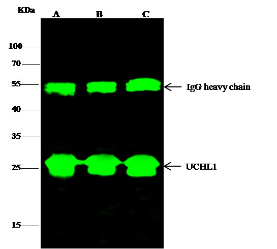 Recombinant UCHL1/PGP9.5 Monoclonal Antibody - small - 2