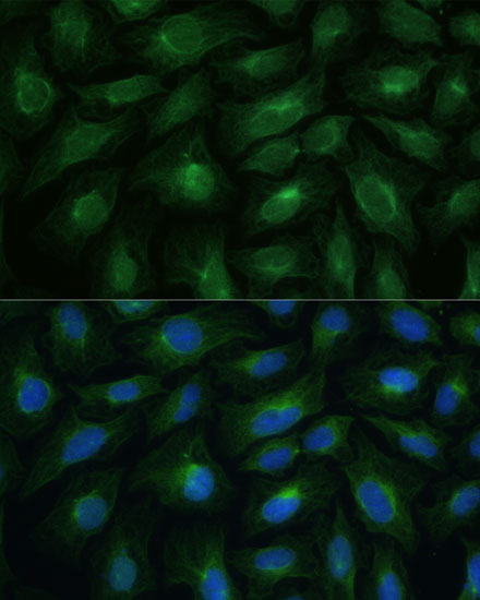 Immunofluorescence analysis of U2OS cells using CNNM1 Polyclonal Antibody at dilution of 1:100. Blue: DAPI for nuclear staining.