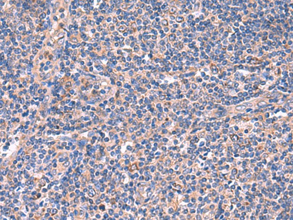 Immunohistochemistry of paraffin-embedded Human tonsil tissue  using MPP1 Polyclonal Antibody at dilution of 1:50(?200)