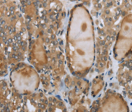 GGT1 Polyclonal Antibody - 3