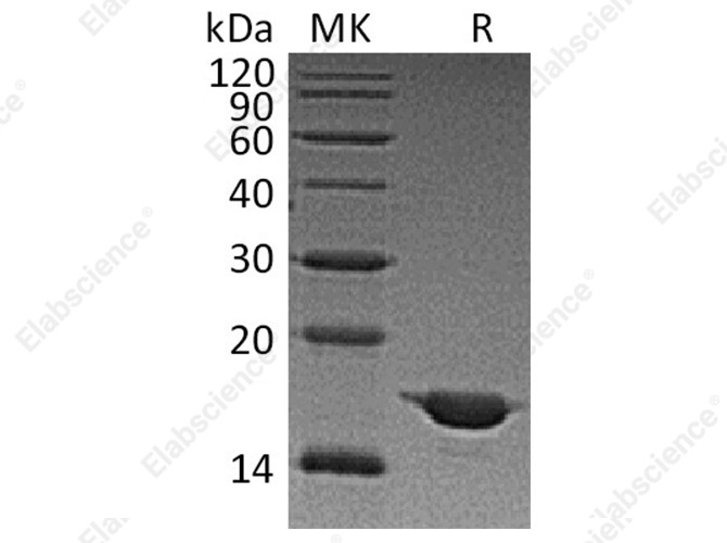 Recombinant Human Alpha-Synuclein/SNCA Protein - 1