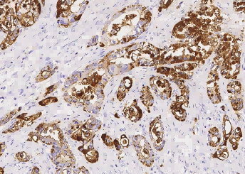 Recombinant TSPAN1 Monoclonal Antibody - small - 2