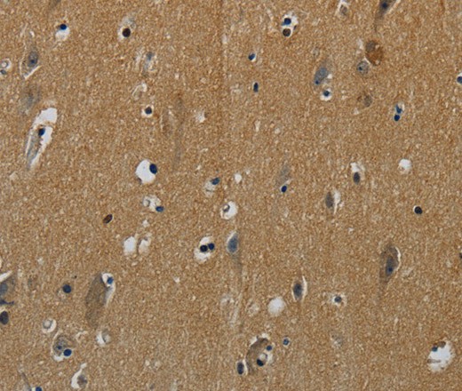 Immunohistochemistry of paraffin-embedded Human brain tissue using PIK3CG Polyclonal Antibody at dilution 1:50