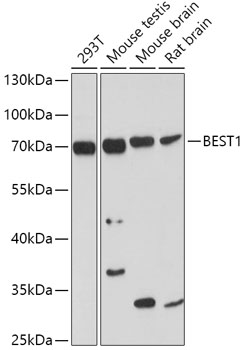Western blot analysis of extracts of various cell lines using BEST1 Polyclonal Antibody at 1:1000 dilution.