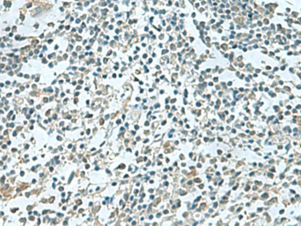 Immunohistochemistry of paraffin-embedded Human tonsil tissue  using SHTN1 Polyclonal Antibody at dilution of 1:60(?200)