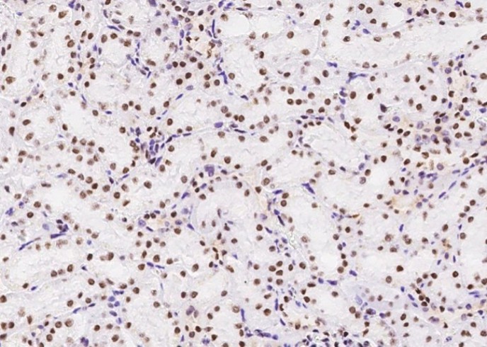 Recombinant MSH6/GTBP Monoclonal Antibody - small - 11