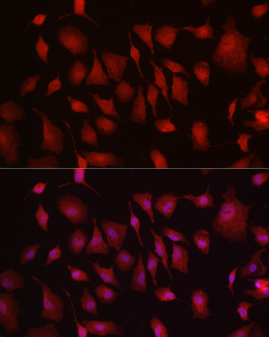 Immunofluorescence analysis of A-549 cells using HK3 Polyclonal Antibody at dilution of 1:150 (40x lens). Blue: DAPI for nuclear staining.