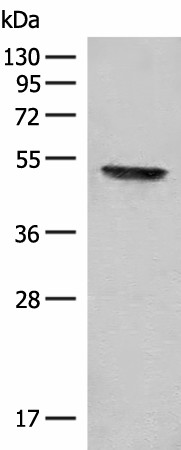 Western blot analysis of Mouse thymus tissue lysate  using FGL2 Polyclonal Antibody at dilution of 1:300