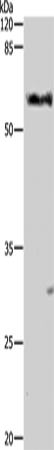 Western Blot analysis of Mouse liver tissue using ALDH1A1/2/3 Polyclonal Antibody at dilution of 1:400