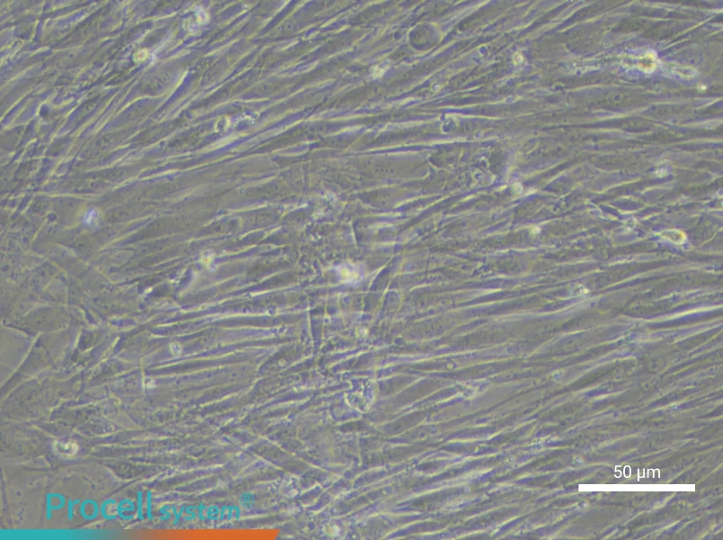 Human Pulmonary Arteriolar Smooth Muscle Cell Complete Medium - 5