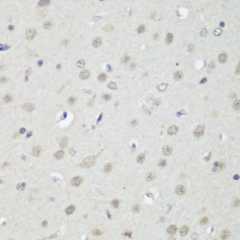 Immunohistochemistry of paraffin-embedded Rat brain using CTCF Polyclonal Antibody at dilution of  1:200 (40x lens).