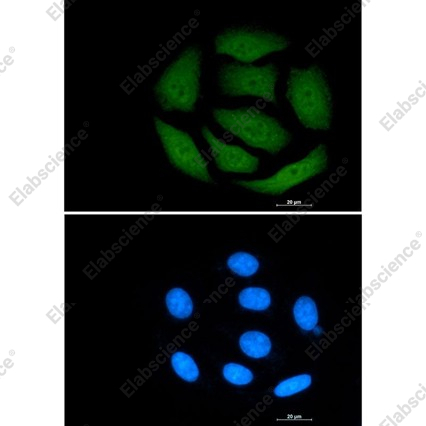 Recombinant VCP Monoclonal Antibody - 3