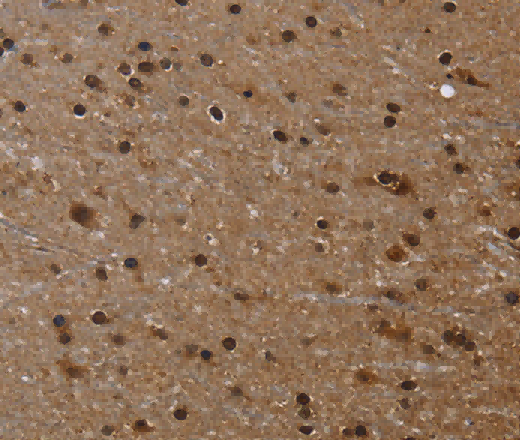 FLNA Polyclonal Antibody - 3