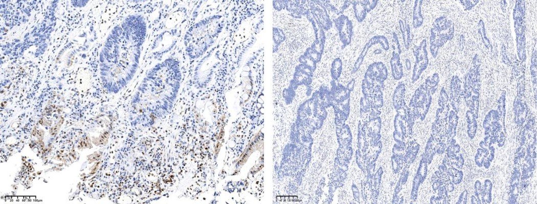 Recombinant Phospho-p38 MAPK (Thr180, Tyr182) Monoclonal Antibody-searchlist-1