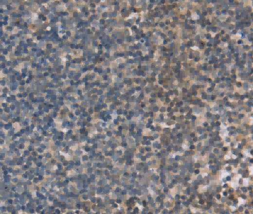 OTC Polyclonal Antibody - 3
