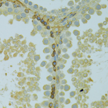 Immunohistochemistry of paraffin-embedded Rat testis using KCNJ1 Polyclonal Antibody at dilution of  1:100 (40x lens).