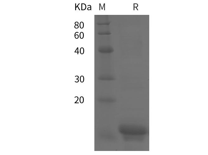 Recombinant Human CXCL5 Protein-产品推荐-1