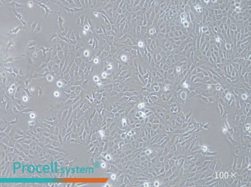 143B Cell Complete Medium - 2