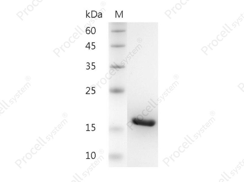 IL-1&beta;/IL1F2, Human, Recombinant