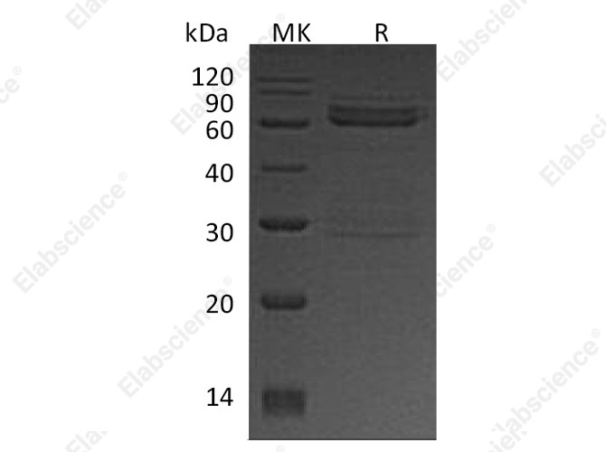 Recombinant Human CAMK1D Protein (GST Tag) - 1