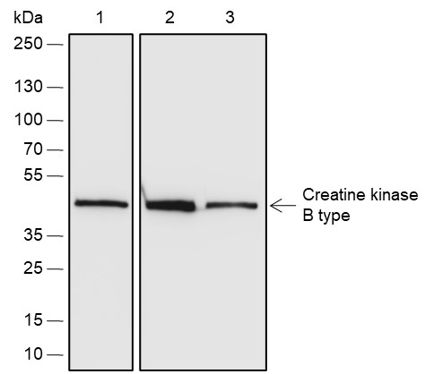 Recombinant Creatine kinase B type Monoclonal Antibody-searchlist-1