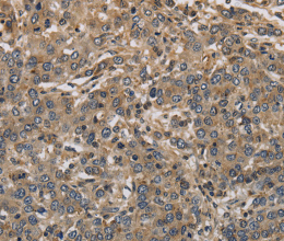 KCNA7 Polyclonal Antibody - 2