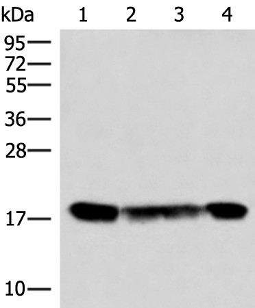 Western blot analysis of 293T and 231 cell lysates  using PEMT Polyclonal Antibody at dilution of 1:800