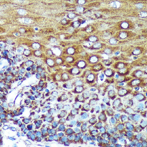 Immunohistochemistry of paraffin-embedded Human esophageal using SPECC1L Polyclonal Antibody at dilution of 1:100 (40x lens).Perform microwave antigen retrieval with 10 mM PBS buffer pH 7.2 before commencing with IHC staining protocol.